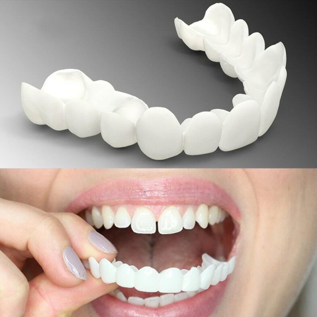 Image of carillas dentales postizas/dentaduras dentales postizas/cubierta falsa de silicón #4