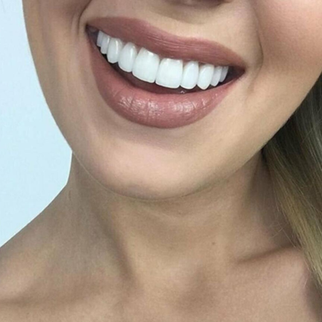 Image of carillas dentales postizas/dentaduras dentales postizas/cubierta falsa de silicón #3
